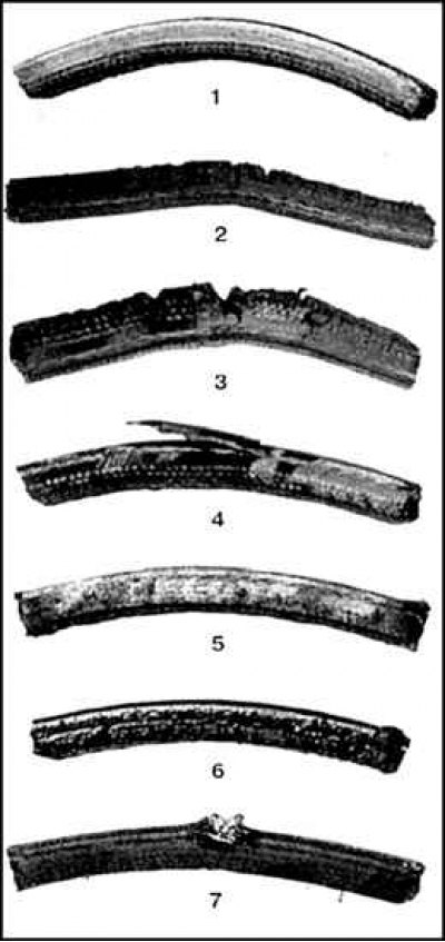 2. Обугливание